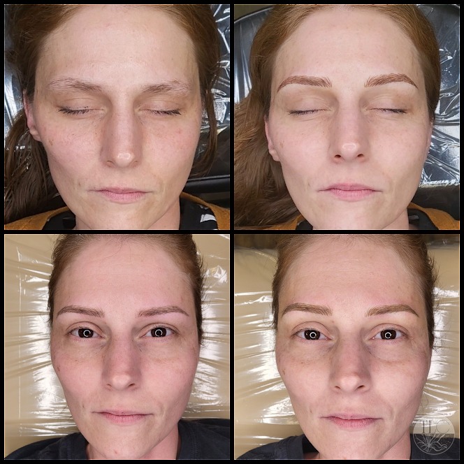 Why Do I Need to Wait 6+ Weeks Before My Touch-Up?
